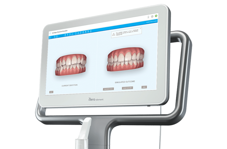 iTero 4 Crow Canyon Orthodontics in San Ramon, CA